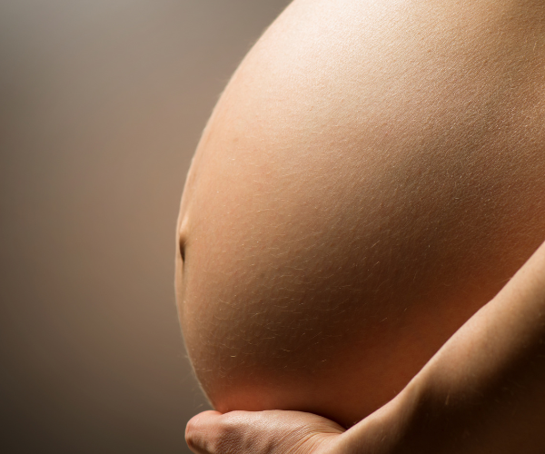 Prevenir estrías embarazo: Guía efectiva para futuras mamás